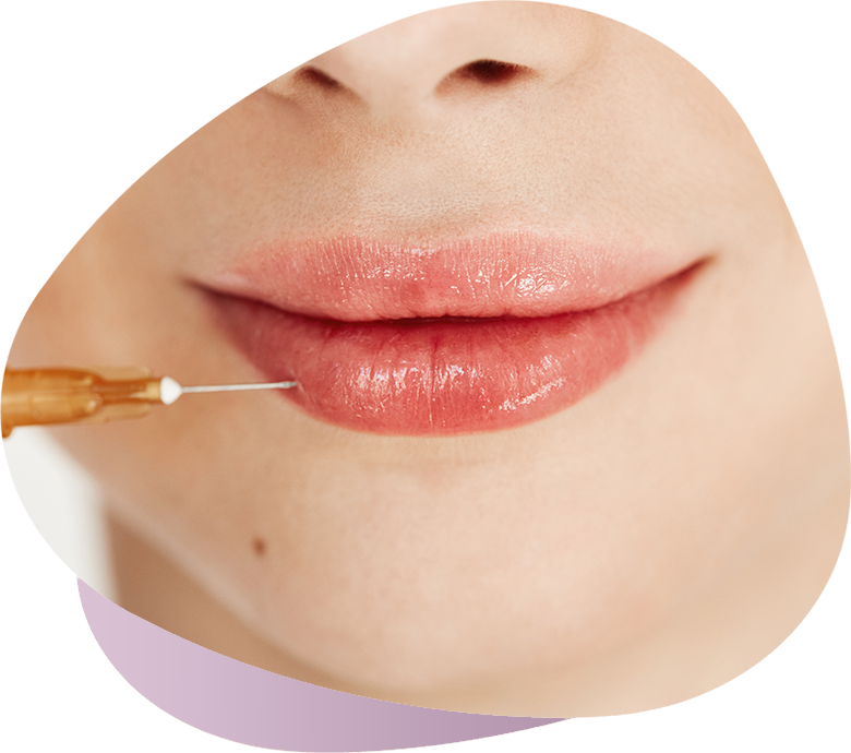 Lip Fillers İhsan Türkmen